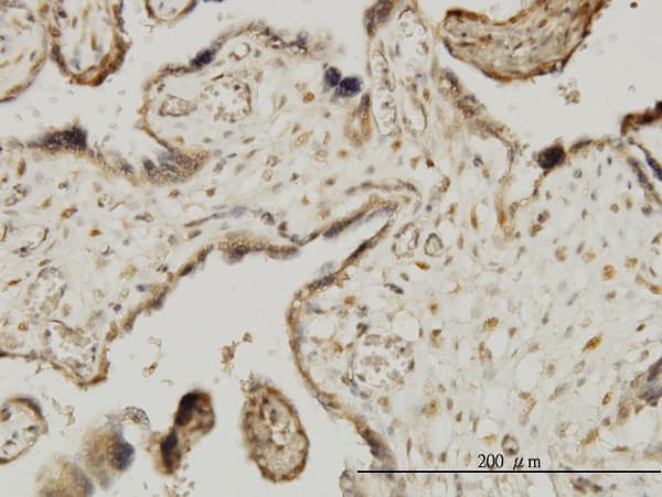 MAPKAPK3 Antibody (clone 2B5)