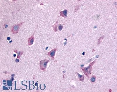 IHC-plus™ Polyclonal Rabbit anti-Human QRFPR / GPR103 Antibody (N-Terminus, IHC)
