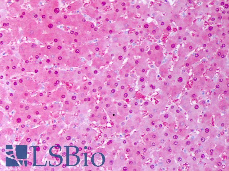 SOD1 / Cu-Zn SOD Antibody (Biotin)