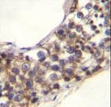PNLDC1 Antibody (aa449-478)