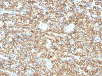 CD99 Antibody (clone HO36-1.1, Ready-to-Use)