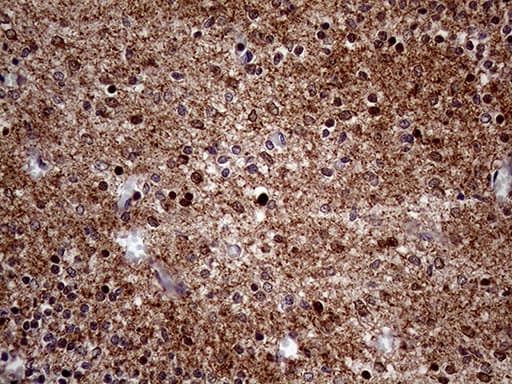 Monoclonal Mouse anti-Human MAPT / Tau Antibody (clone OTI13E11, aa623-758, IHC, WB)