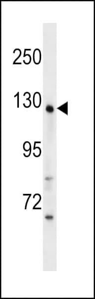 WDR64 Antibody (aa14-42)