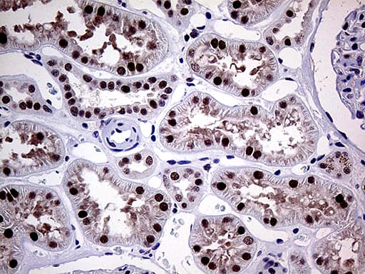 MLH1 Antibody (aa299-527, clone OTI3C1)