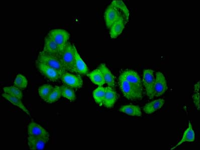 ACY3 Antibody