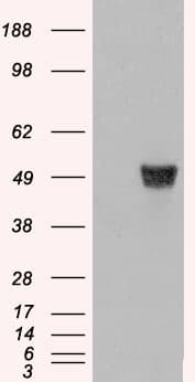 PathPlus™ Polyclonal Goat anti-Human CORO1A / Coronin 1a Antibody (aa546-558, IHC, WB)