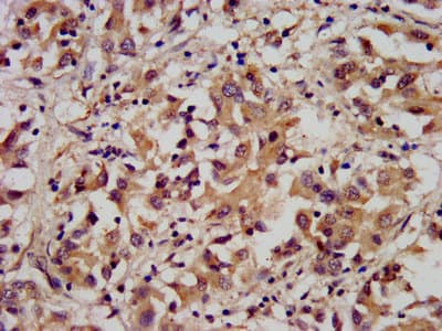 Polyclonal Rabbit anti-Human ARL1 Antibody (IHC, IF)
