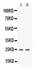 Polyclonal Rabbit anti-Rat FGF19 Antibody (WB)