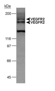 KDR / VEGFR2 / FLK1 Antibody (Internal, Biotin)