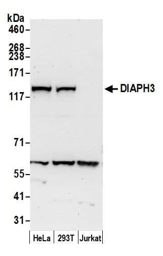 DIAPH3 / MDIA2 Antibody (aa1-50)