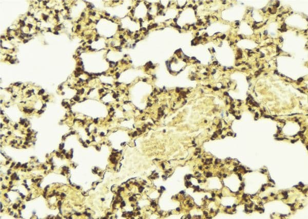 SREBF1 / SREBP-1 Antibody (phospho-Ser439)