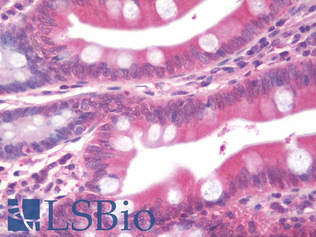 WC1 / ATP7B Antibody (aa3-21, clone S62-29, FITC)