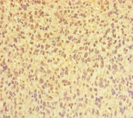 Polyclonal Rabbit anti-Human CHTOP / FOP Antibody (IHC, WB)
