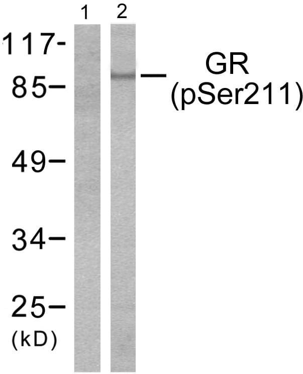 Polyclonal Rabbit anti-Human NR3C1/Glucocorticoid Receptor Antibody (phospho-Ser211, IHC, WB)