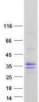 Human MESP1 Protein (Recombinant Myc-DDK (Flag))