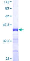 Human RFX5 Protein (Recombinant GST, N-terminus)