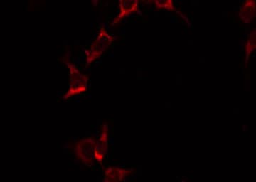 Polyclonal Rabbit anti-Human ANXA10 / Annexin A10 Antibody (IF, WB)
