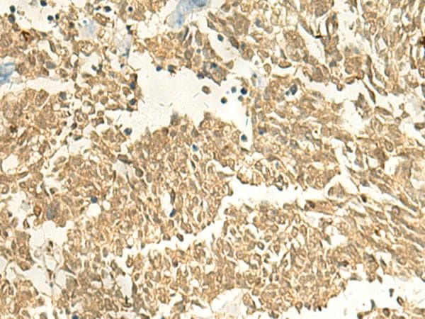 METTL10 Antibody