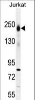 IHC-plus™ Polyclonal Rabbit anti-Human CD45 / LCA Antibody (aa336-364, IHC, WB)