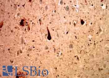 Ubiquitin Antibody (clone Ubi-1-AP)