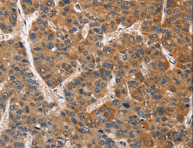 Polyclonal Rabbit anti-Human BRCC45 / BRE Antibody (IHC, WB)