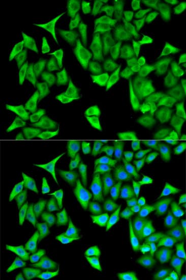 PSMD9 / 26S Proteasome Antibody