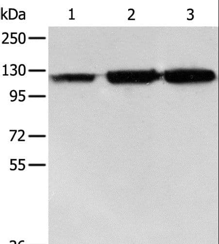 Polyclonal Rabbit anti-Human HSPH1 / HSP105 Antibody (WB)