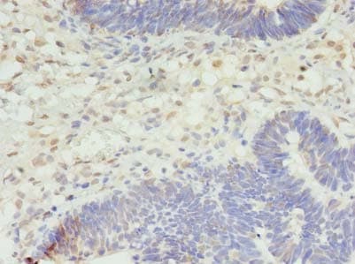 STK38L / NDR2 Antibody