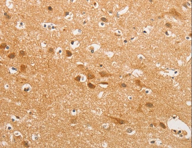 Polyclonal Rabbit anti-Human CDH6 / K Cadherin Antibody (IHC, WB)