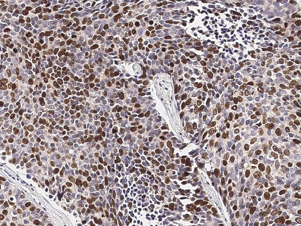 MKI67 / Ki67 Antibody (clone 22, Preservative Free)