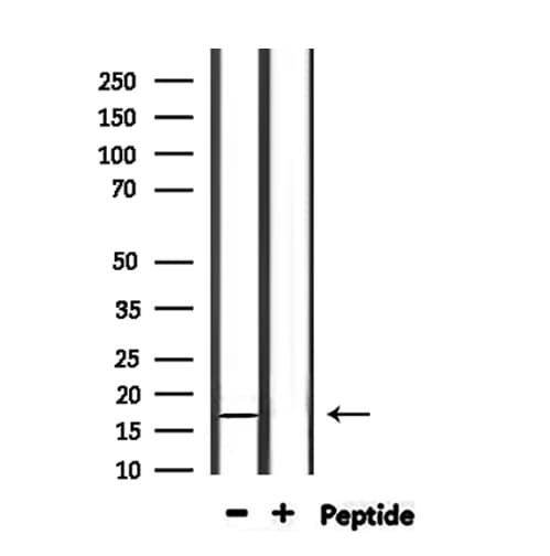 Polyclonal Rabbit anti-Human NDUFA13 / GRIM19 Antibody (IHC, WB)