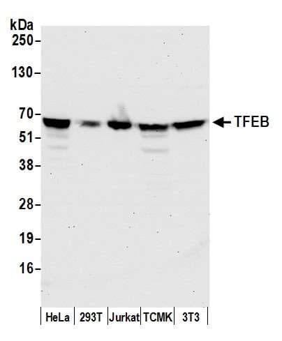 TFEB Antibody (aa426-476)