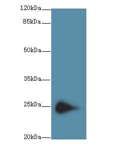 Polyclonal Rabbit anti-Human TMEM174 Antibody (IHC, WB)