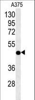 Polyclonal Rabbit anti-Human CS / Citrate Synthase Antibody (aa27-55, IHC, WB)