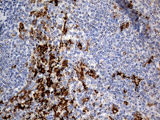 PTPN22 / PEP Antibody (aa359-449, clone OTI6B1)