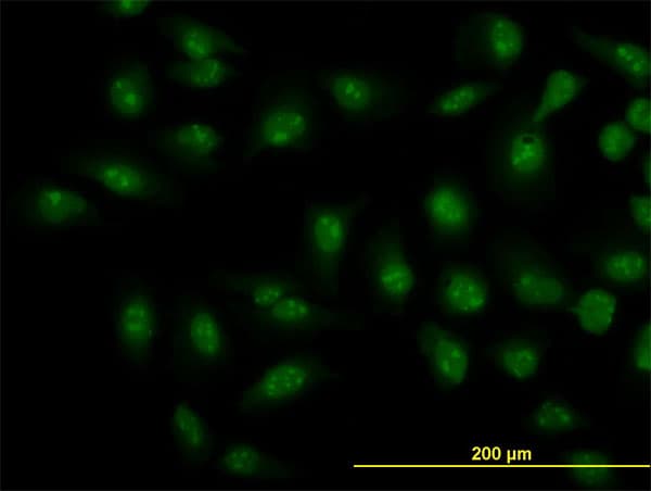 Monoclonal Mouse anti-Human SMAD1 Antibody (clone 2A1, IF, WB)