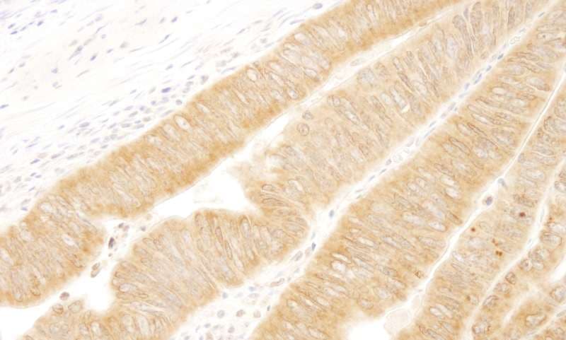 Polyclonal Rabbit anti-Human UVRAG Antibody (aa649-699, IHC)