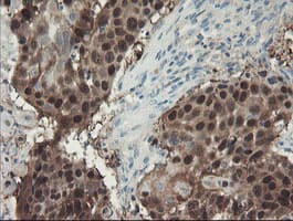 IHC-plus™ ADH7 Antibody (clone 2D11)