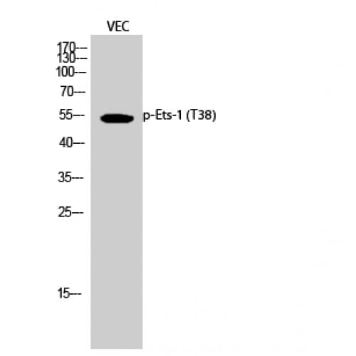 Polyclonal Rabbit anti-Human ETS1 / ETS-1 Antibody (30-110 aa, IHC, IF, WB)