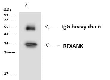 Polyclonal Rabbit anti-Human RFXANK Antibody (WB)