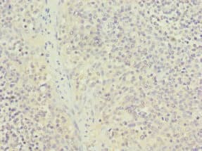 NUTF2 / PP15 Antibody