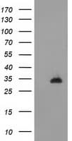 CTDSP1 / SCP1 Antibody (clone OTI1A7, Carrier-free)