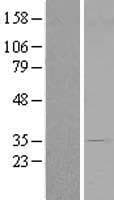 CENPV / p30 Protein (Over-Expression Lysate Myc-DDK (Flag))