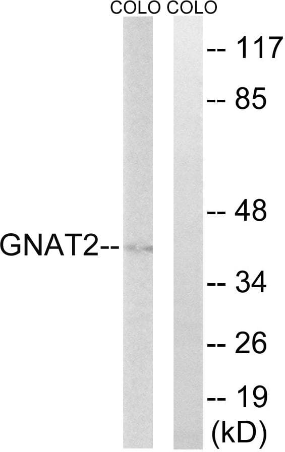 Polyclonal Rabbit anti-Human GNAT2 Antibody (WB)
