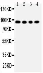ADAM17 / TACE Antibody (aa806-824)