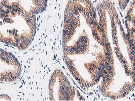 FAM40A Antibody (clone OTI7B8)