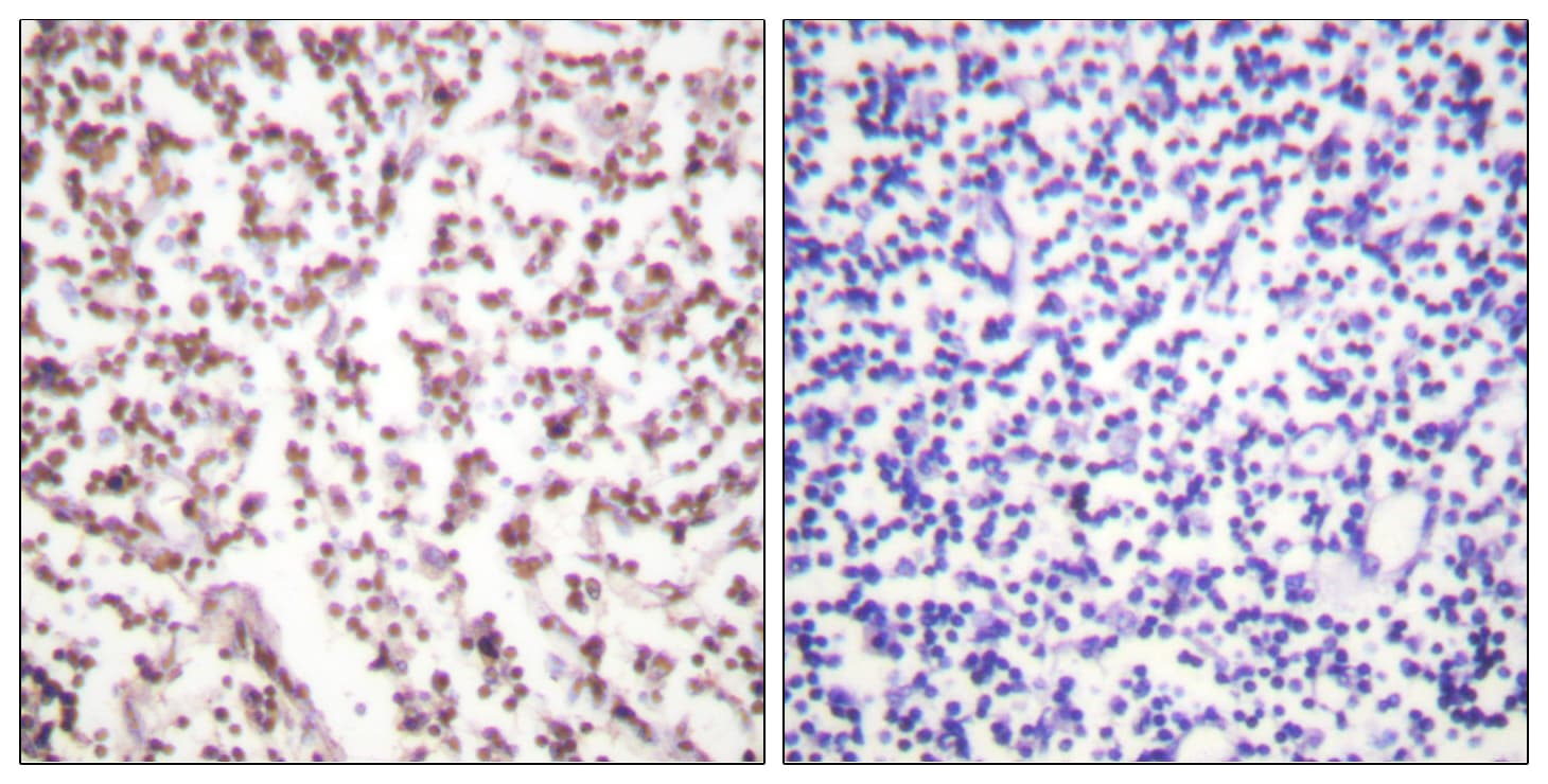 Polyclonal Rabbit anti-Human BLM Antibody (aa65-114, IHC, IF)