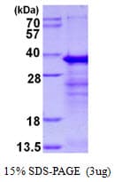 Human RYBP Protein (Recombinant His)