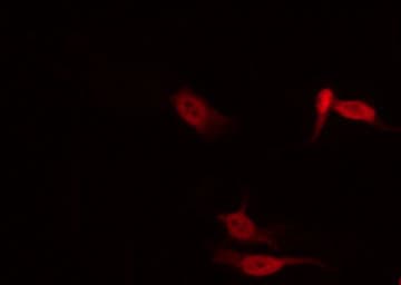 STAT1 Antibody (phospho-Ser727)