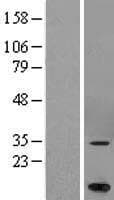 MARCH5 Protein (Over-Expression Lysate Myc-DDK (Flag))